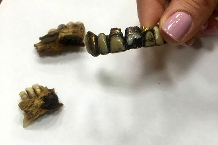 адольф гитлер, смерть гитлера, гитлер аргентина, гитлер бразилия, гитлер экспертиза, куда сбежал гитлер, где прятался гитлер, челюсть гитлера, череп гитлера