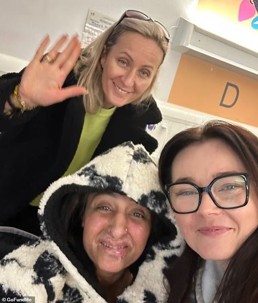 Женщина из Великобритании потеряла все конечности после того, как тяжелый сепсис резко осложнил ее состояние